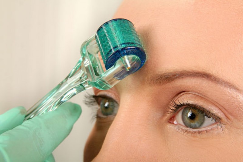 [Анна Нисенман] Интенсив “Мезотерапия самостоятель_0.jpg